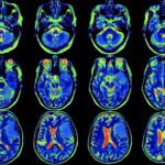 thumb_shutterstock_2647866703